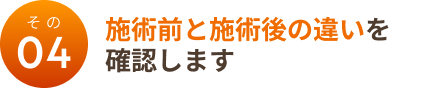 その4：施術前と施術後の違いを確認します